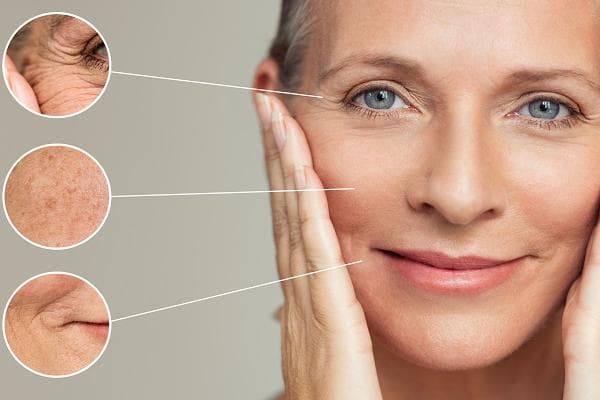 Face Lift Surgery