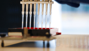 Tissue Typing Laboratory 1