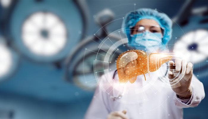 Liver Transplant